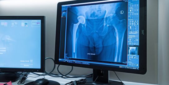 Bildgebung unterstützt Diagnostik